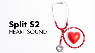 Fixed Split S2  Heart Sounds  MEDZCOOL [upl. by Sven]