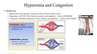 Pathology Made Easy 4 Hemodynamic Disorders [upl. by Asia870]