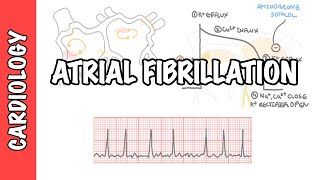 Atrial Fibrillation Overview  ECG types pathophysiology treatment complications [upl. by Grenier]