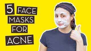 5 Homemade Face Masks for Acne That Really Work [upl. by Douglass583]